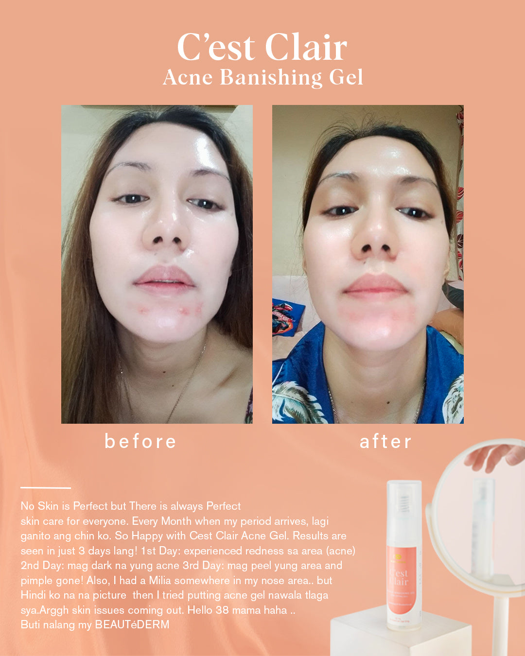 Beautederm Cest Clair Acne Drying Gel Before After Testimonial